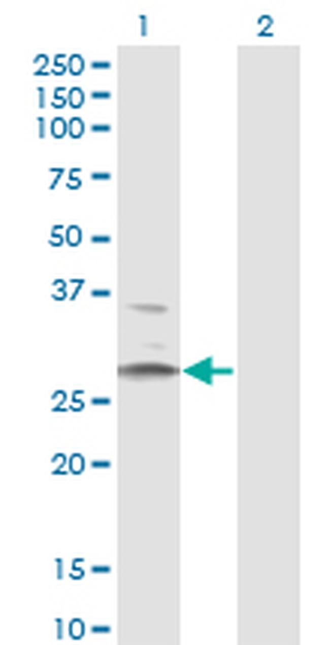 HSD11B1 Antibody in Western Blot (WB)