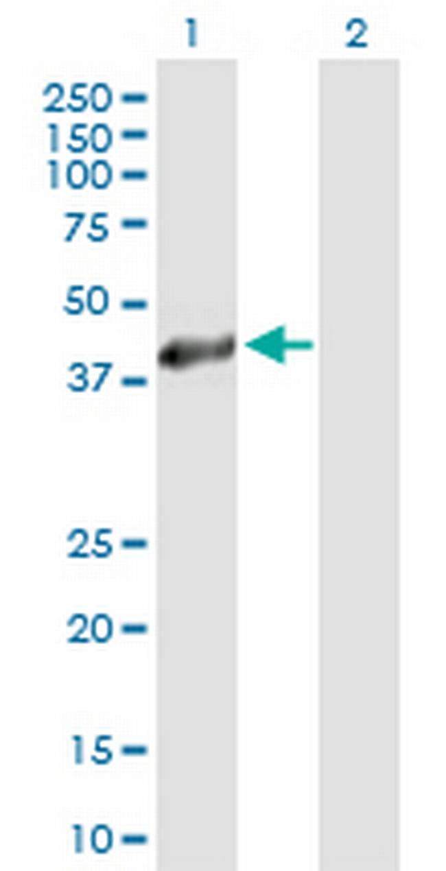 HSD11B2 Antibody in Western Blot (WB)