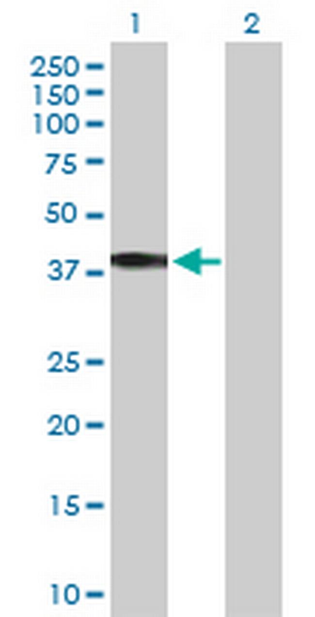 HSD11B2 Antibody in Western Blot (WB)