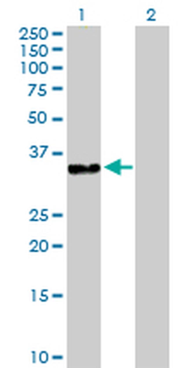 DNAJB2 Antibody in Western Blot (WB)