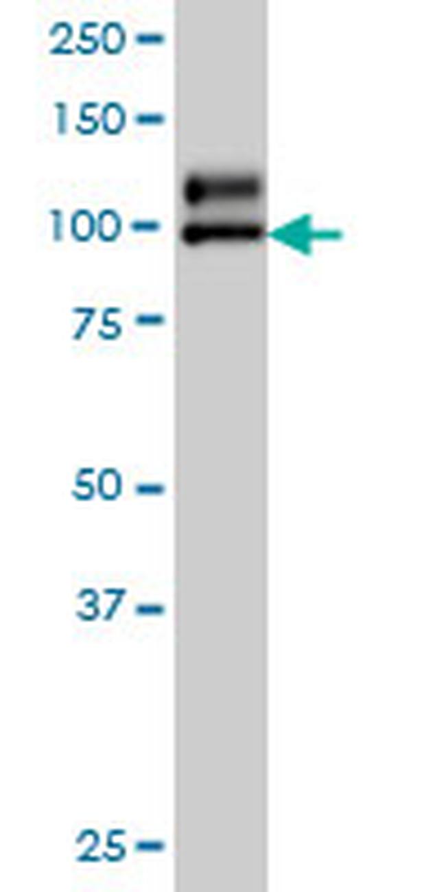 NDST1 Antibody in Western Blot (WB)