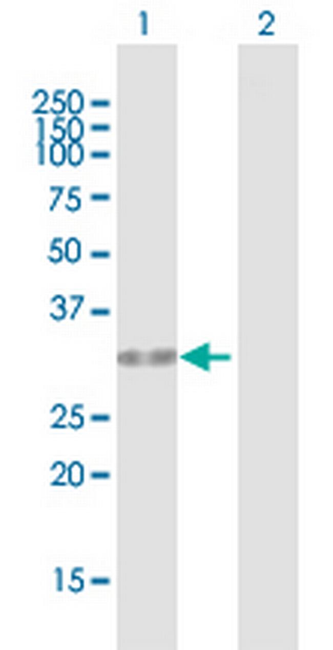 HUS1 Antibody in Western Blot (WB)