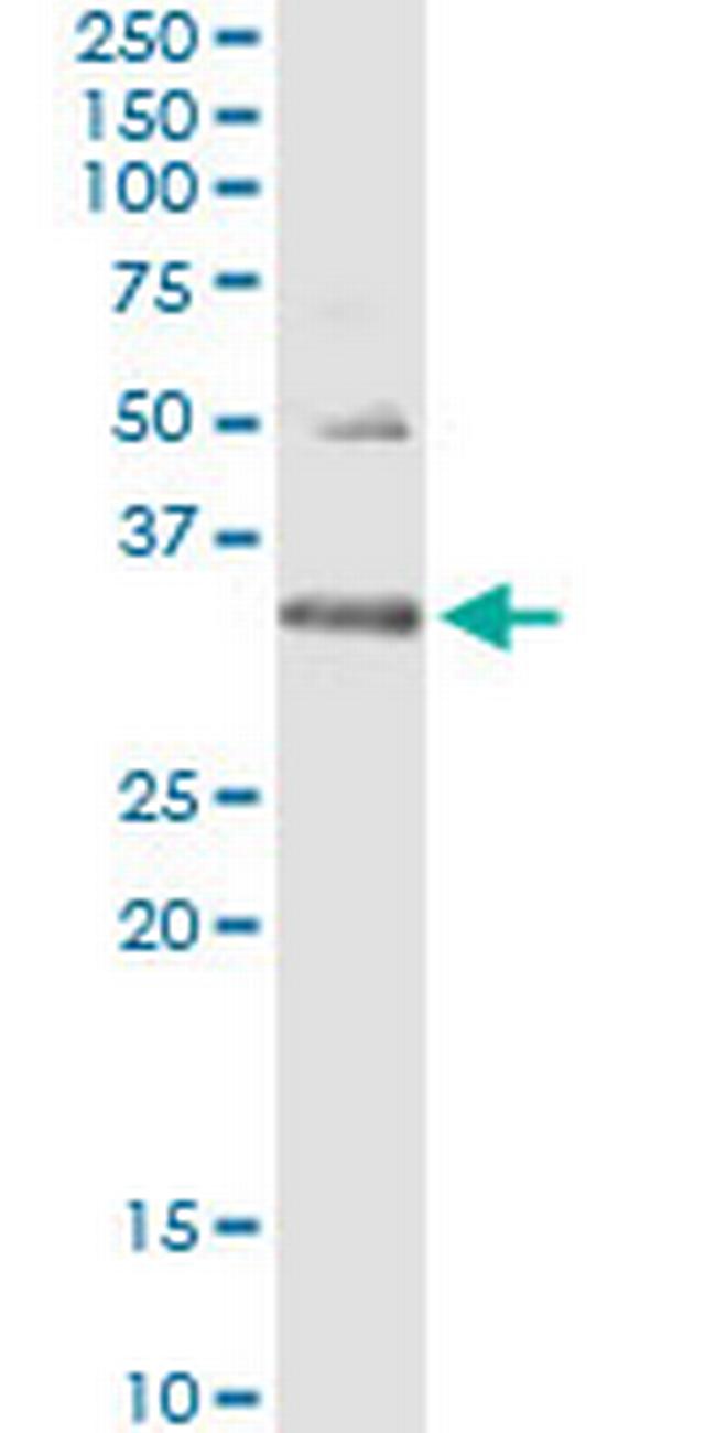 HUS1 Antibody in Immunoprecipitation (IP)