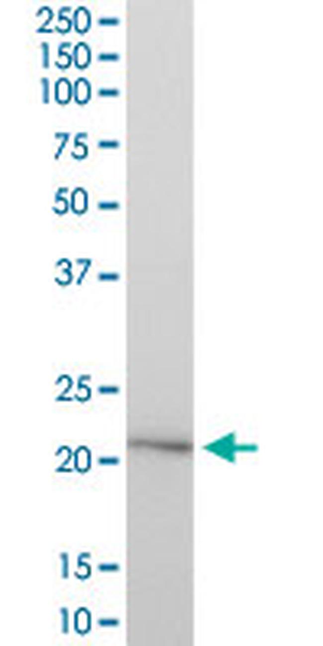 HYAL1 Antibody in Western Blot (WB)