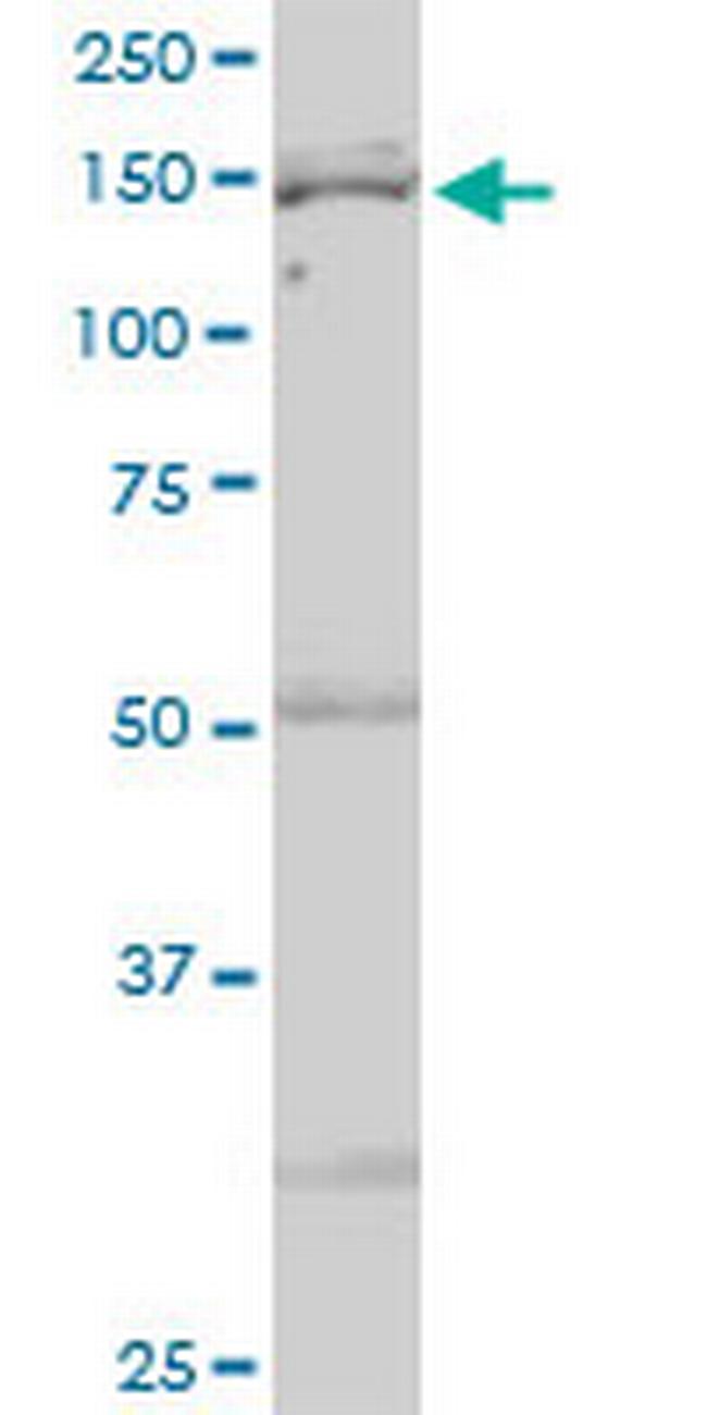 IARS Antibody in Western Blot (WB)