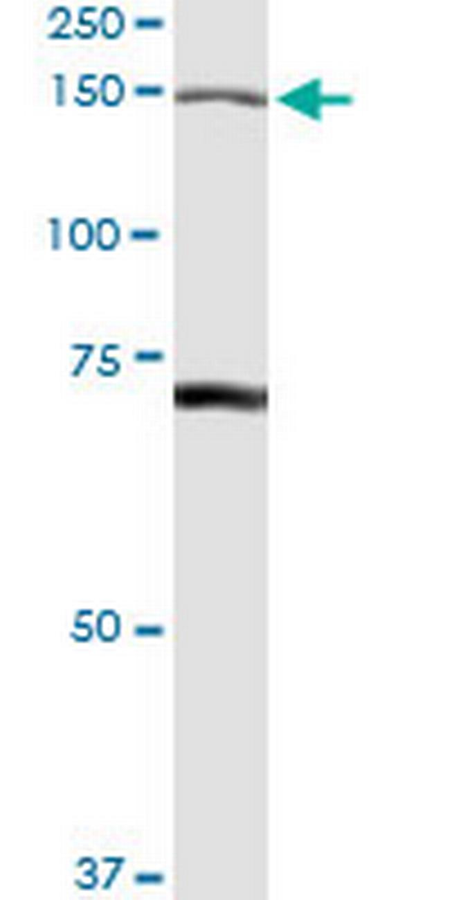 IARS Antibody in Western Blot (WB)