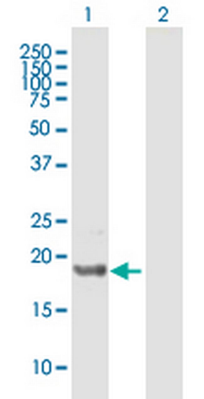 ICT1 Antibody in Western Blot (WB)