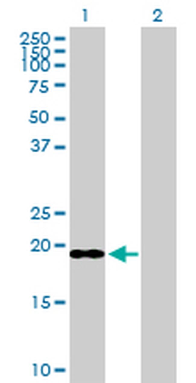 ICT1 Antibody in Western Blot (WB)