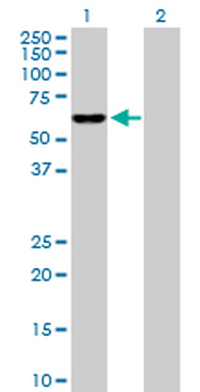 IDH3B Antibody in Western Blot (WB)