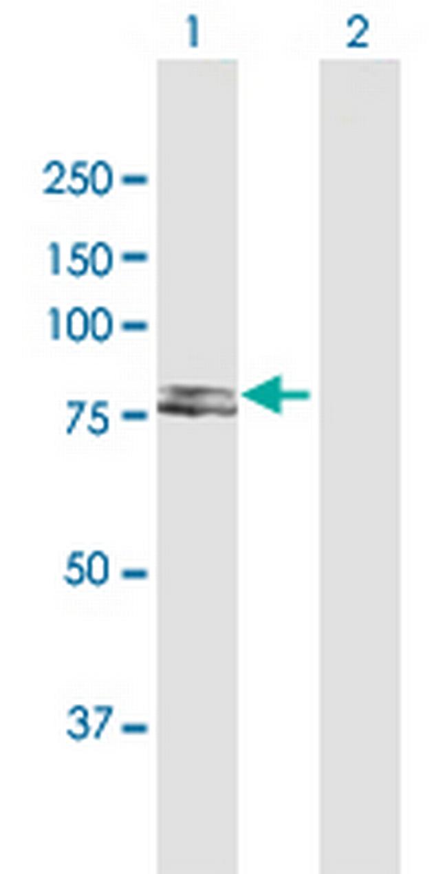 IDS Antibody in Western Blot (WB)