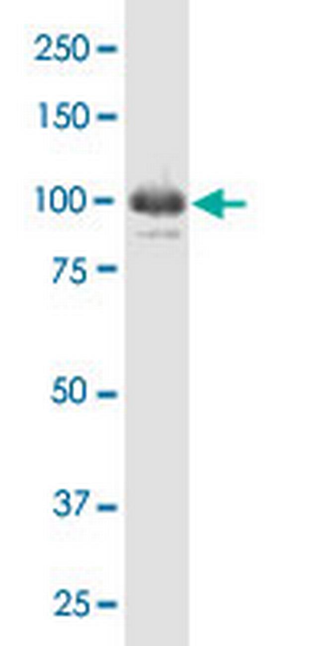 IFI16 Antibody in Western Blot (WB)