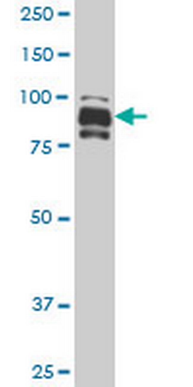 IFI16 Antibody in Western Blot (WB)