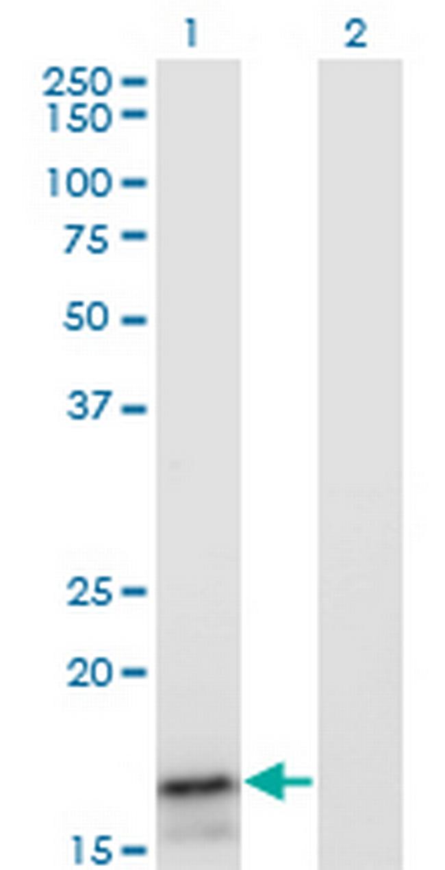 IFNA2 Antibody in Western Blot (WB)