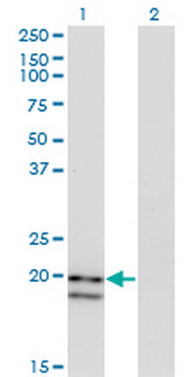 IFNA2 Antibody in Western Blot (WB)