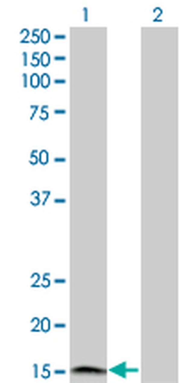 IFNA2 Antibody in Western Blot (WB)