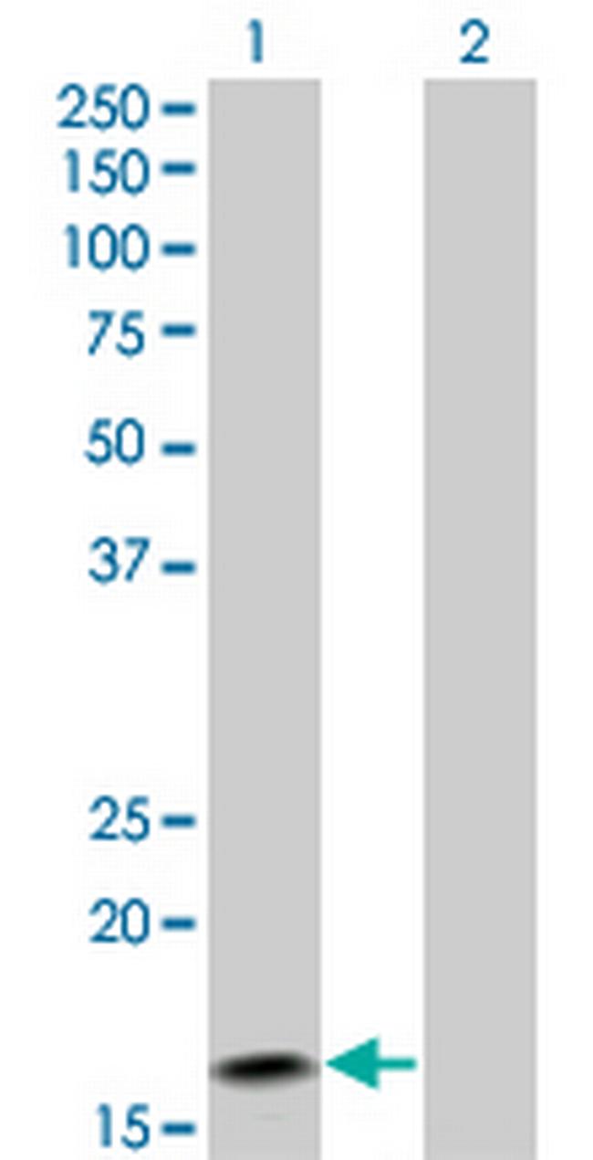 IFNA2 Antibody in Western Blot (WB)