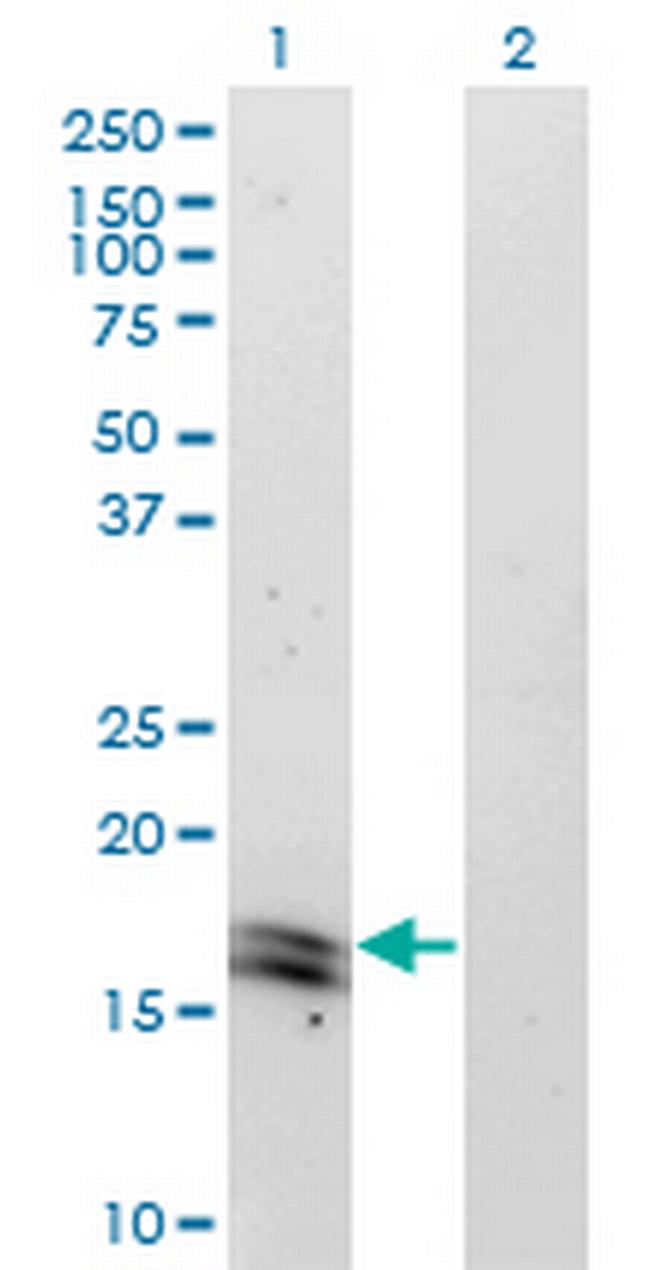 IFNA2 Antibody in Western Blot (WB)