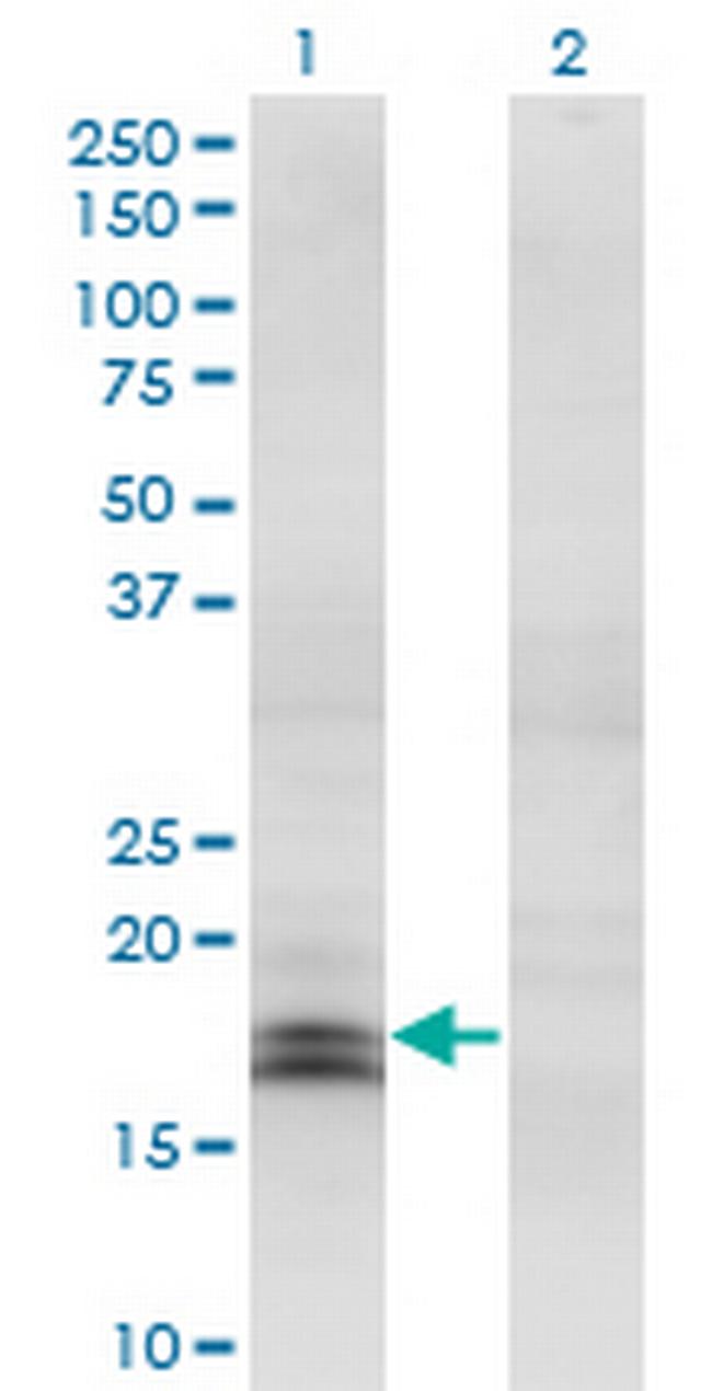 IFNA2 Antibody in Western Blot (WB)
