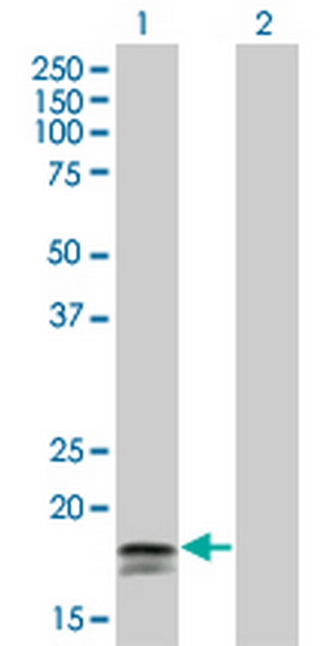 IFNA2 Antibody in Western Blot (WB)