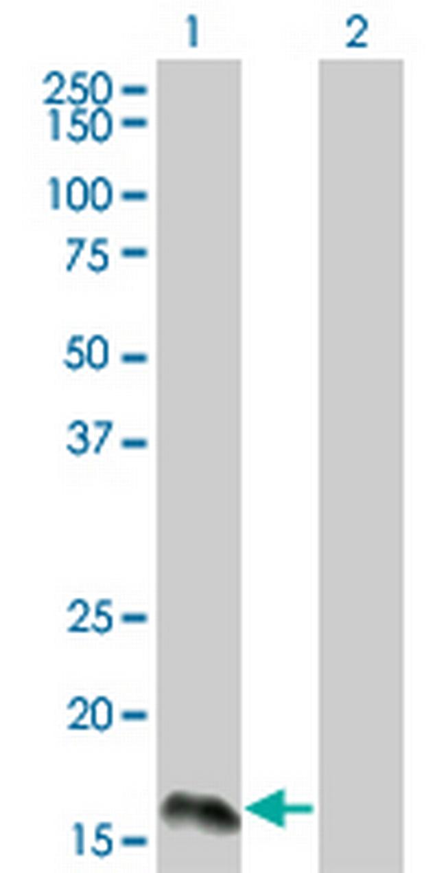 IFNA2 Antibody in Western Blot (WB)