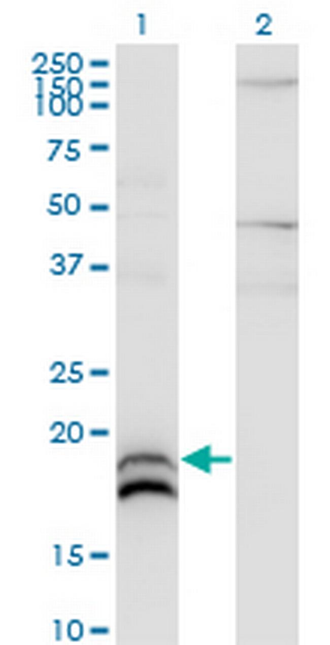 IFNA2 Antibody in Western Blot (WB)