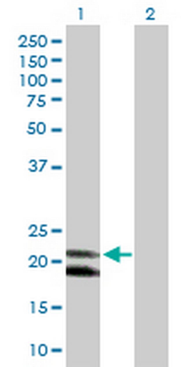 IFNA4 Antibody in Western Blot (WB)