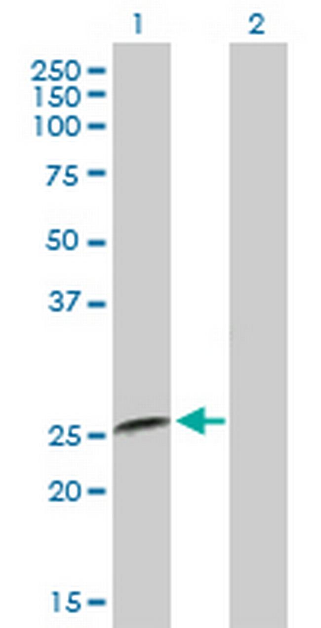 IFNA8 Antibody in Western Blot (WB)