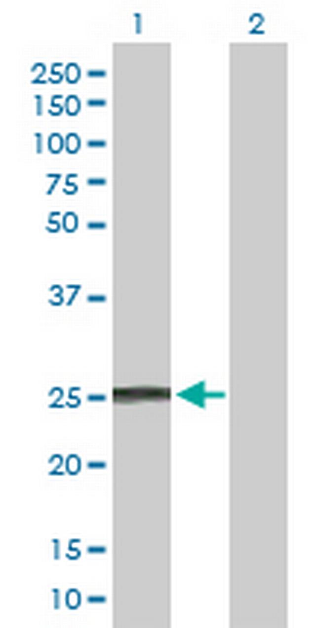 IFNA8 Antibody in Western Blot (WB)