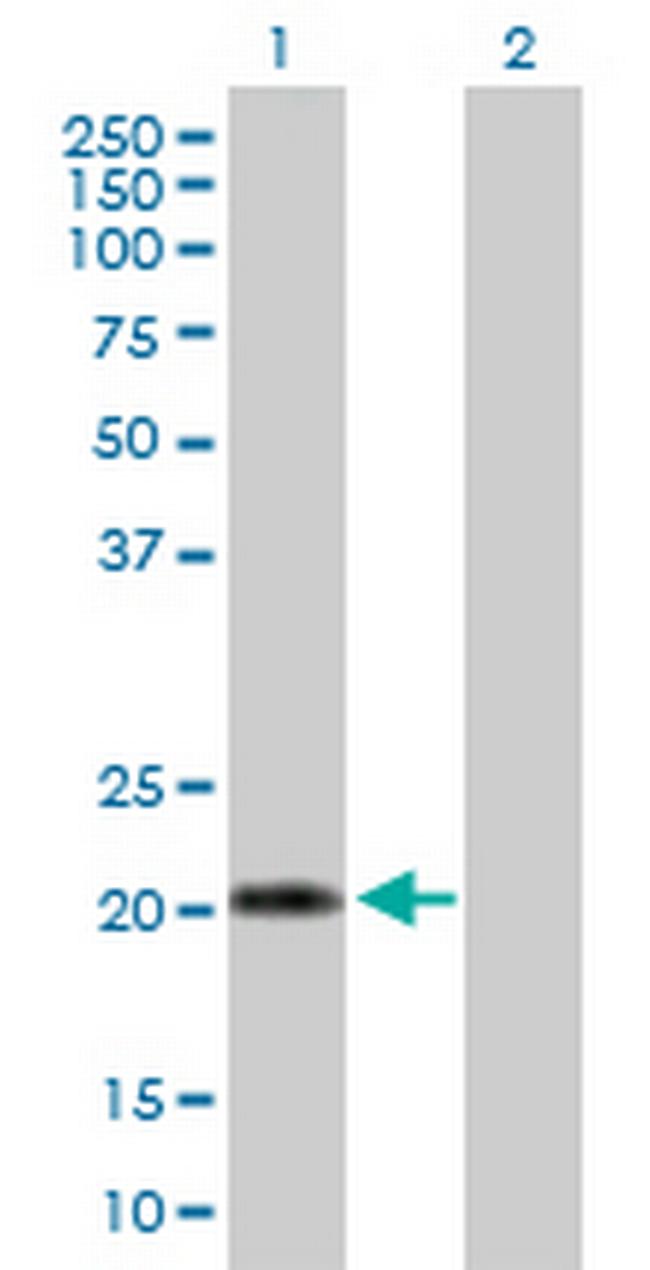 IFNA10 Antibody in Western Blot (WB)