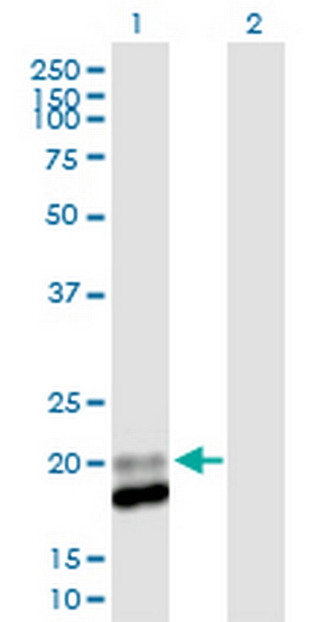 IFNA13 Antibody in Western Blot (WB)