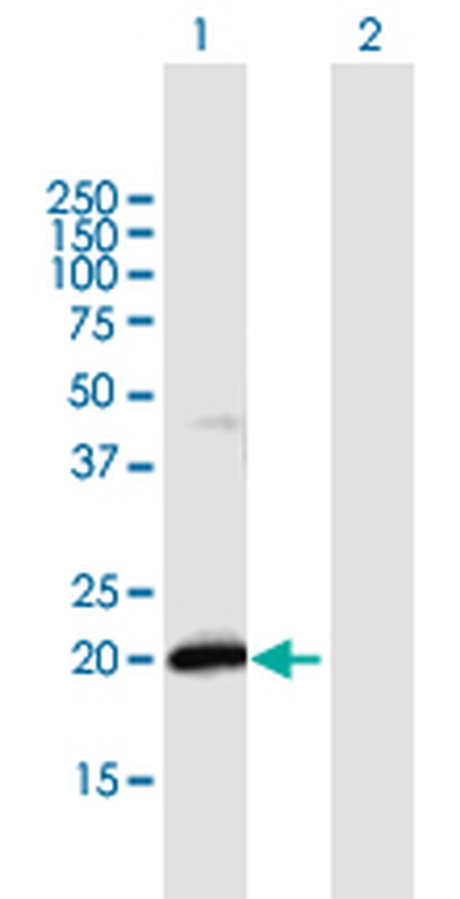 IFNA21 Antibody in Western Blot (WB)