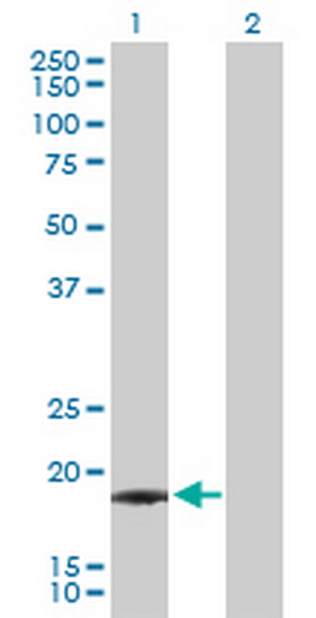 IFNA21 Antibody in Western Blot (WB)