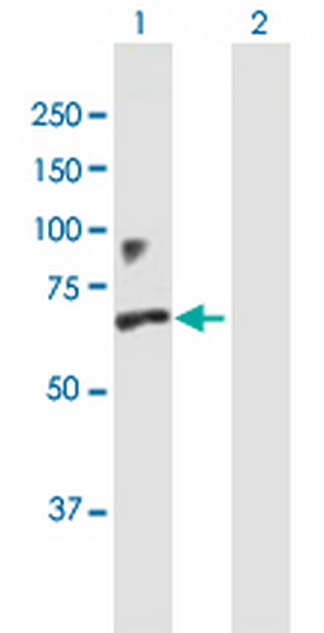 IFNAR1 Antibody in Western Blot (WB)