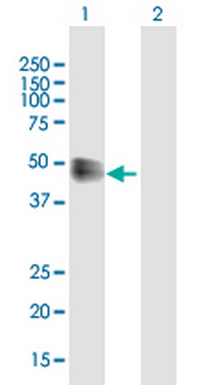 IFNAR2 Antibody in Western Blot (WB)