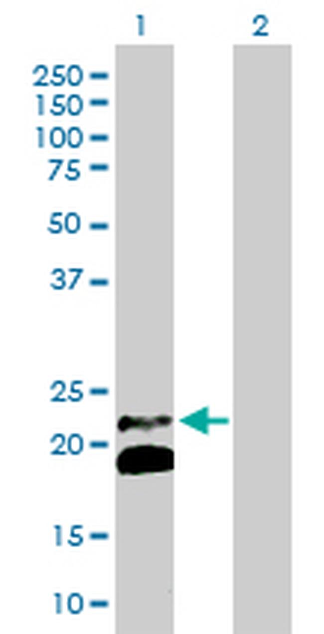 IFNB1 Antibody in Western Blot (WB)