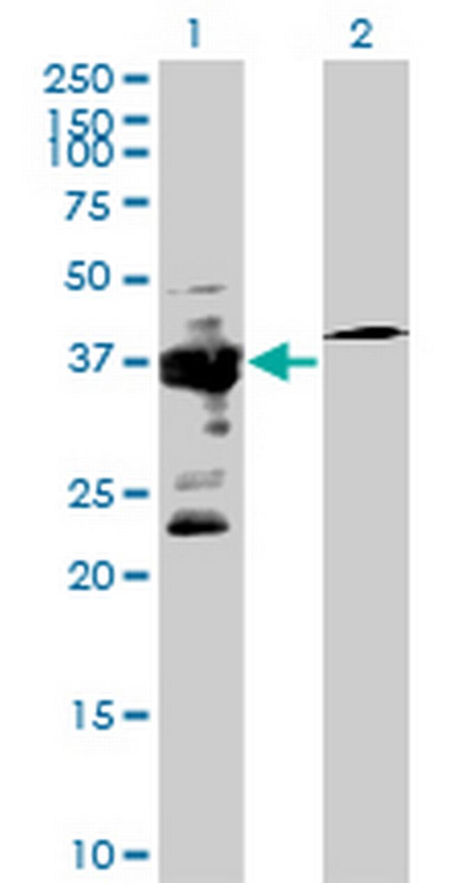 IGBP1 Antibody in Western Blot (WB)