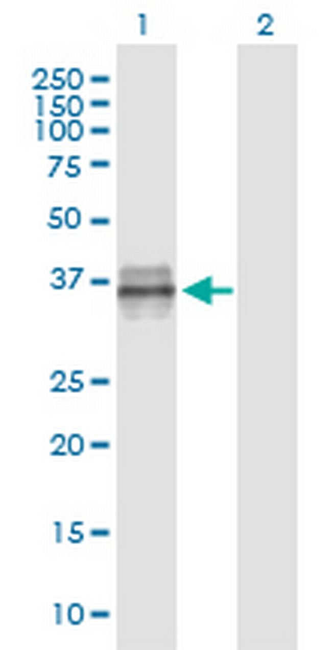 IGFBP3 Antibody in Western Blot (WB)