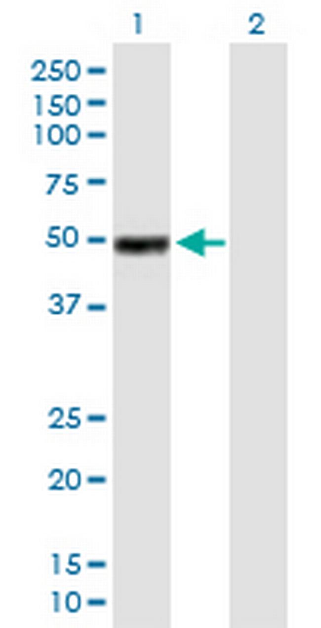 IGHG1 Antibody in Western Blot (WB)