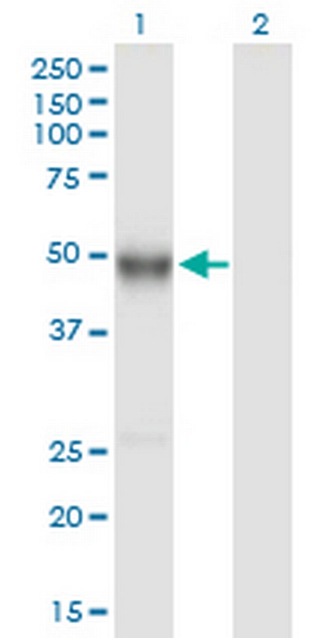 IGHG4 Antibody in Western Blot (WB)