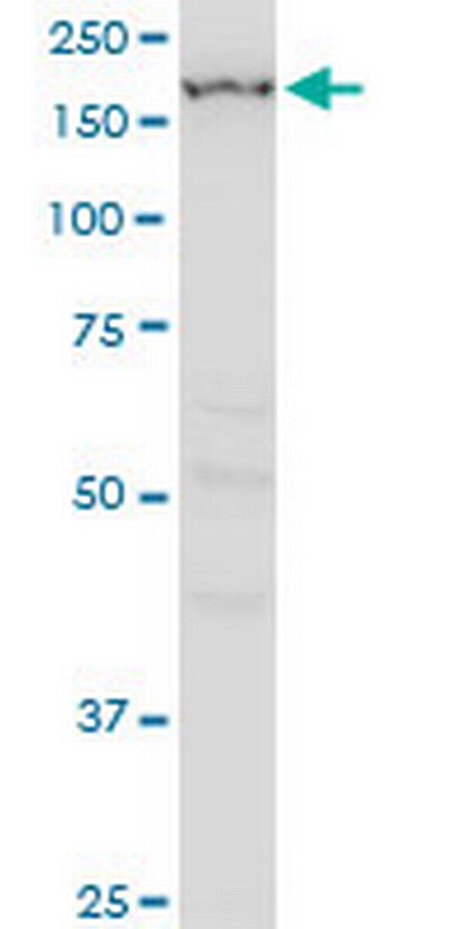 IGSF1 Antibody in Western Blot (WB)