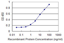 IKBKB Antibody in ELISA (ELISA)