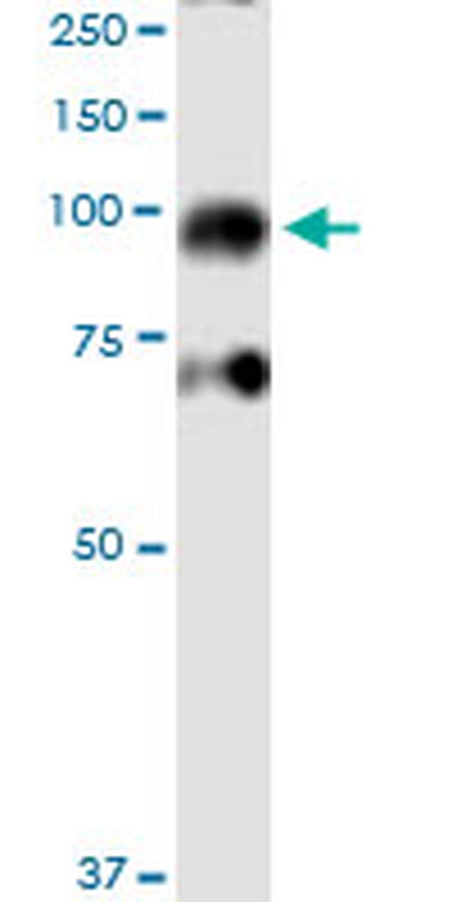 IKBKB Antibody in Western Blot (WB)