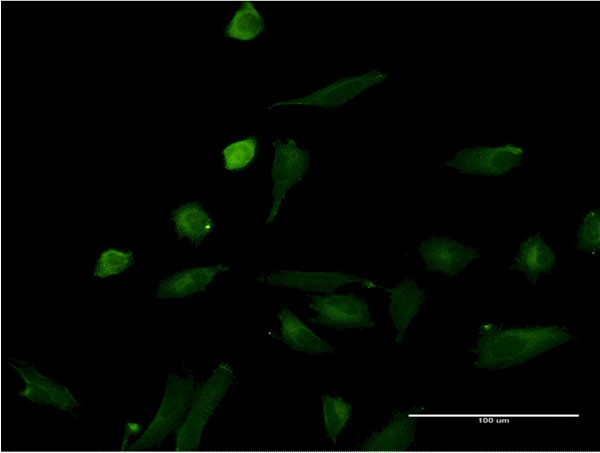 IL1A Antibody in Immunocytochemistry (ICC/IF)