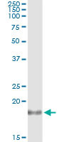 IL1RN Antibody in Immunoprecipitation (IP)