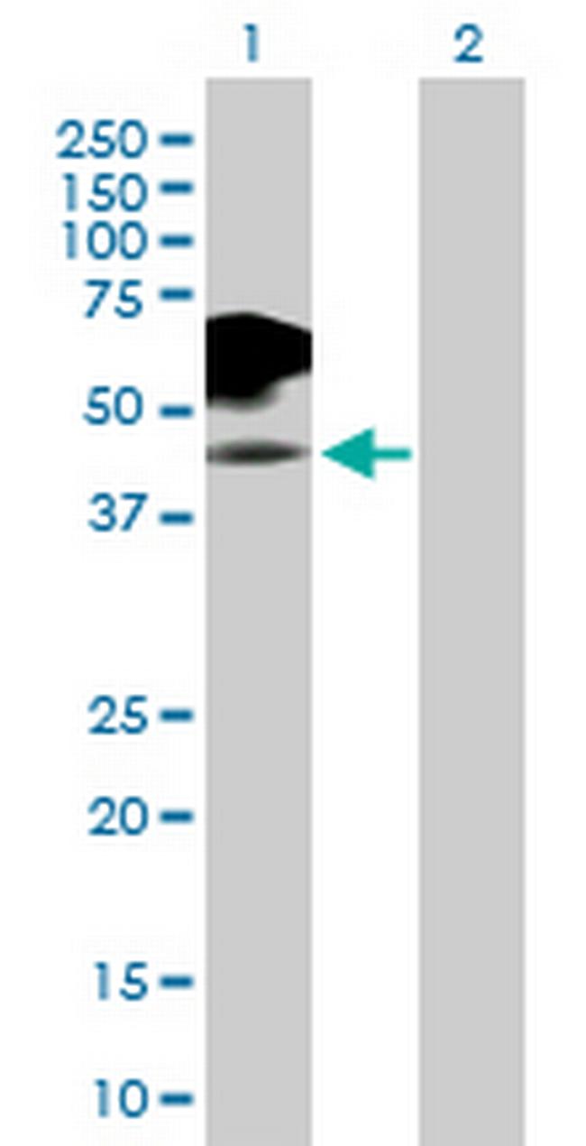 IL2RG Antibody in Western Blot (WB)