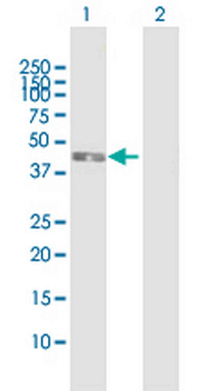 IL5RA Antibody in Western Blot (WB)