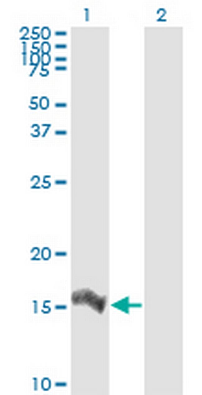 IL8 Antibody in Western Blot (WB)