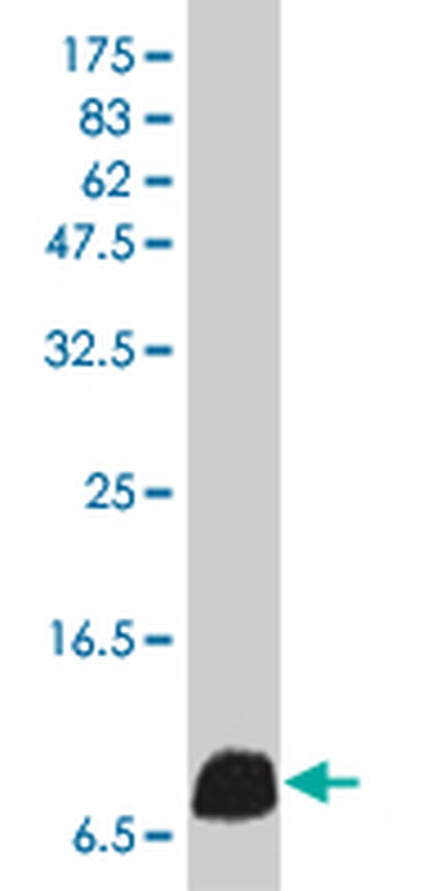 IL8 Antibody in Western Blot (WB)