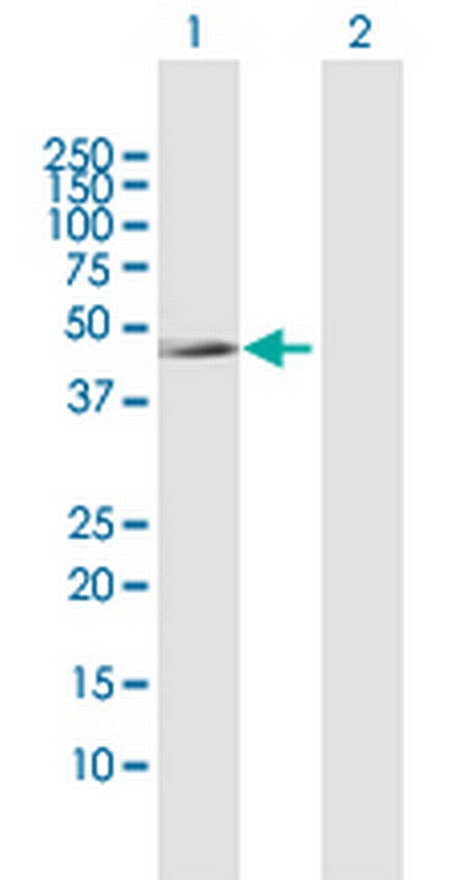 IL10RB Antibody in Western Blot (WB)