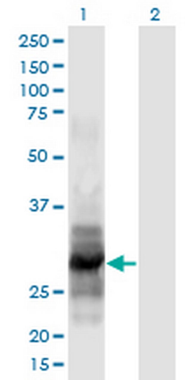 IL12A Antibody in Western Blot (WB)